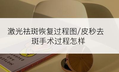 激光祛斑恢复过程图/皮秒去斑手术过程怎样