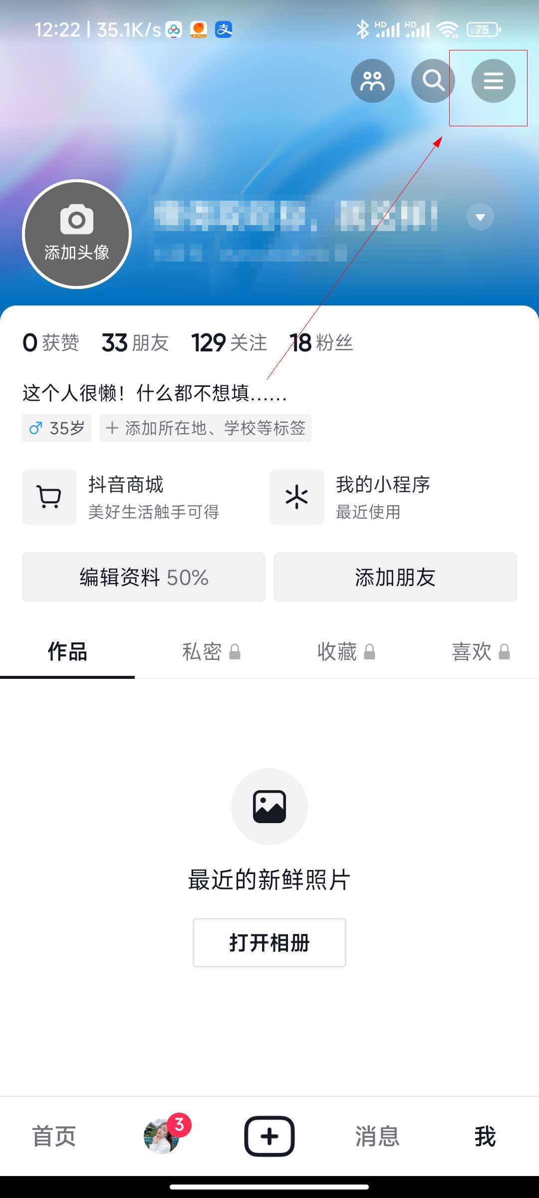 抖音极速版买的东西在哪里看订单